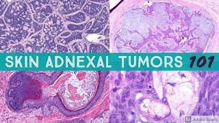 Skin Adnexal Tumors 101 A Basic Approach for General Pathologists [upl. by Caro]