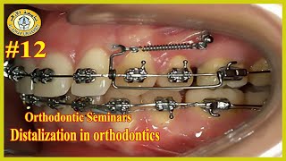 12 Distalization in orthodontics سيمينارات تقويم الأسنان جامعة الأزهر [upl. by Sternick]