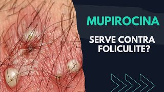 POMADA MUPIROCINA SERVE CONTRA FOLICULITE  DESCUBRA [upl. by Cassady]