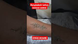 Bangladesh tattoo remove centre [upl. by Annaor31]