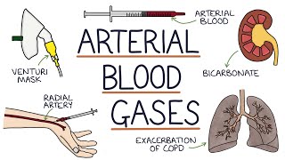 Understanding Arterial Blood Gases [upl. by Peirsen]