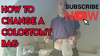 How to change a colostomy stoma bag [upl. by Yoo]