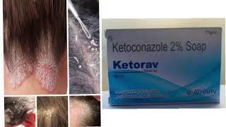 Ketorav Soap Ketoconazole 2 Soap [upl. by Crofton225]