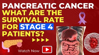 PANCREATIC CANCER  WHAT ARE THE SURVIVAL RATE FOR STAGE 4 PATIENTS [upl. by Anilek]