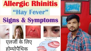 नाक़ की एलर्जी छींक Allergic Rhinitis Homeopathic Treatment नाक़ से पानी आना [upl. by Cj735]