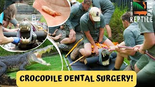 CROCODILE DENTAL SURGERY on Elvis  Australias Crankiest Croc [upl. by Ynolem]