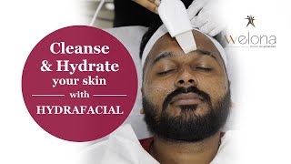 Whats REALLY Happening During a HydraFacial Session  Welona Clinic Chennai [upl. by Eelarat911]