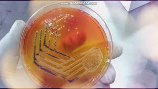 Xylose Lysine Deoxycholate agar  XLD  Selective medium for Salmonella and Shigella [upl. by Winna410]