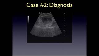 Transabdominal Pelvic Ultrasound [upl. by Maryjane]