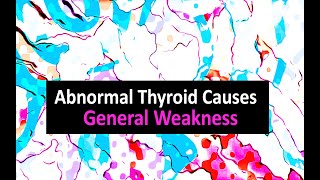 Abnormal Thyroid Causes General Weakness [upl. by Hgielar973]