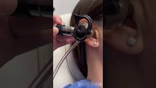 How an ENT Doctor Removes Ear Wax [upl. by Bunting]