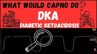 What would CAPNO do DKA [upl. by Decker]