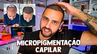 TUDO sobre minha MICROPIGMENTAÇÃO CAPILAR [upl. by Cirilo188]