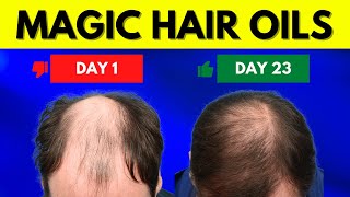 8 Magic Natural Oils for Massive Hair Growth  You Wont Believe It [upl. by Atkins]