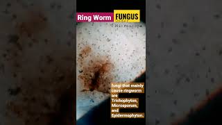 Ringworm Fungus🦠Under Microscope [upl. by Anaugal515]