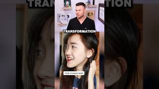 Dentist Reveals SHOCKING Life Changing Jaw Transformation 😮🦷 [upl. by Cesya38]