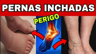 PERNAS INCHADAS  5 Sinais de ALERTA MÁXIMO e 9 Causas de Inchaço nos Pés e Pernas [upl. by Chemosh]