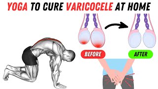 Powerful Yoga Poses to Cure Varicocele at Home [upl. by Celestine]