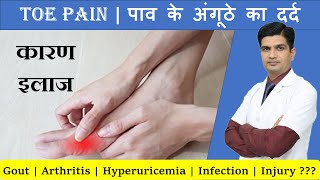 अंगुठे के दर्द का कारण इलाज  Toe pain treatment  Toe pain and swelling [upl. by Anidene]