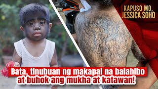 Bata tinubuan ng makapal na balahibo at buhok ang mukha at katawan  Kapuso Mo Jessica Soho [upl. by Twitt]