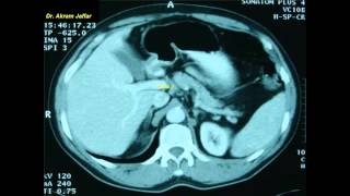 Cross sectional and imaging anatomy of the abdomen [upl. by Arikehs211]