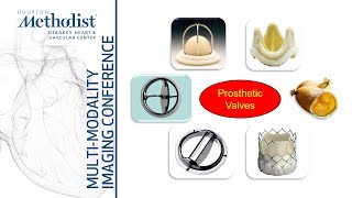 Evaluation of Prosthetic Heart Valves with EchoDoppler Role of CTMRI Zoghbi Chang Shah5322 [upl. by Notkcorb]