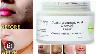 Cosalic Ointment Coaltar amp Salicylic Acid Ointment [upl. by Swayne34]