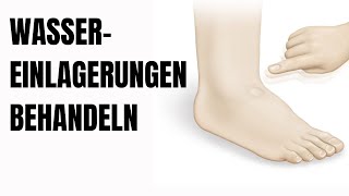 So behandelst du Wassereinlagerungen in den Beinen [upl. by Hakim]