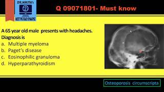 Lytic lesions of skull Differentials [upl. by Enitsirt]