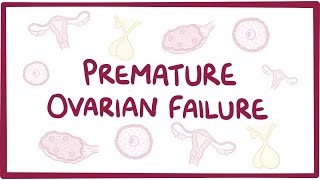 Premature ovarian failure  an Osmosis Preview [upl. by Htieh]