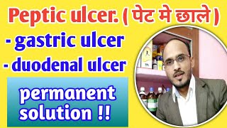 Pepticulcergastric ulcerduodenal ulcerhomeopathic treatmentpepticulcer symptoms cause treatment [upl. by Daahsar842]