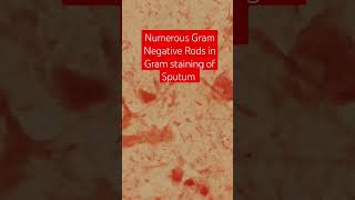 Gram Negative Bacteria in Sputum Gram Staining Microscopy [upl. by Rana]