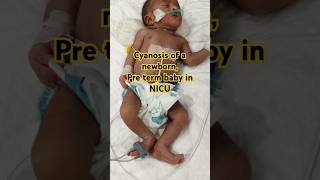 Cyanosis of a newborn  Pre term baby in NICU 🥹 cutebaby baby [upl. by Nireves551]