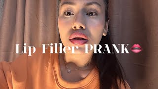 Got Lip Filler DonePRANK On My DadBeaten UpRojina Shrestha [upl. by Nisotawulo]