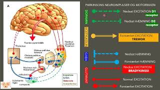 Challenges with Parkinsons disease [upl. by Fredrika]