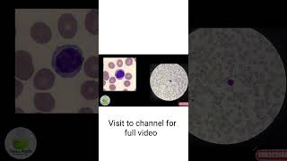 Identify of Lymphocytes lymphocytes wbc cbc [upl. by Inattirb]