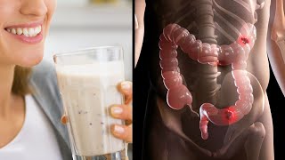 This 2 Ingredient Magical Remedy Flushes POUNDS of Waste From Your Colon [upl. by Kciredec]