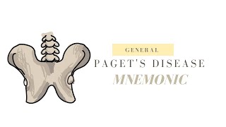 PAGETS DISEASE EASY TIPS AND KEY FEATURES TO REMEMBER [upl. by Annirak]