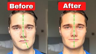 How to Fix Asymmetrical Jaw amp Face TODAY [upl. by Morgun]