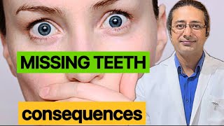 How to identify missing teeth problemsDisadvantages of missing teeth [upl. by Ahterod]