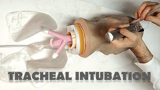 Tracheal tube placement  INTUBATION [upl. by Ahsikam]