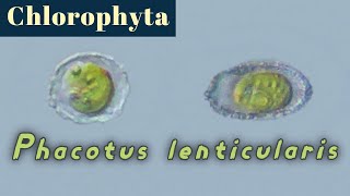 Phacotus lenticularis nanoplankton with calcite lorica Chlorophyta  Green algae [upl. by Enahc]