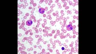 Eosinophils [upl. by Terhune]