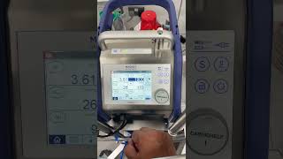 Cardiohelp ECMO [upl. by Ecirb]