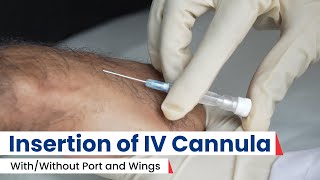 IV Cannulation Insert IV Cannula Tips amp Techniques  Best Procedure 2024 [upl. by Oryaj847]