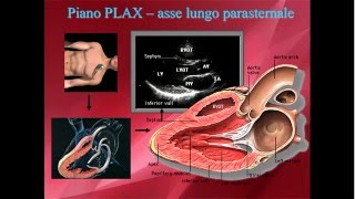 Elementi di ecocardiografia IV video anatomia proiezioni primo approccio pratico [upl. by Tonie44]