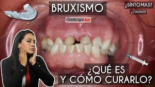 Bruxismo 😬 ¿Qué es y cómo curarlo ✅  Odontología Láser [upl. by Drugi868]