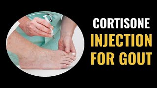 Cortisone Injection For Gout [upl. by Japha]