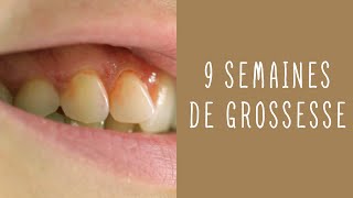 9 semaines de grossesse [upl. by Levison]