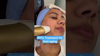 HIFU TREATMENT 360wellness drcherry antiaging [upl. by Moise]